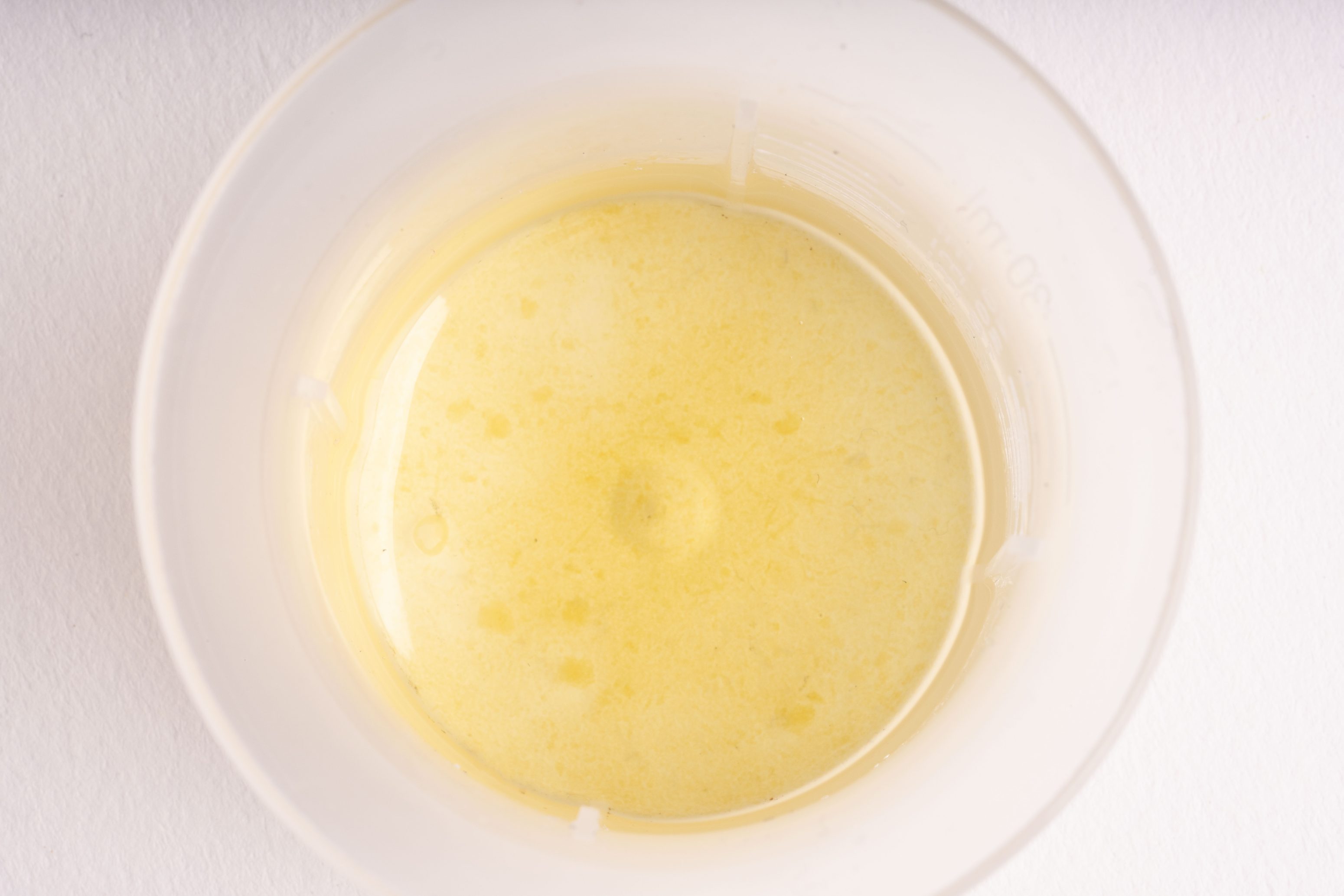Nahaufnahme eines klaren Plastikbechers, der mit einer gelblichen Flüssigkeit, möglicherweise einer Urinprobe, gefüllt ist, auf einer weißen Fläche von oben.